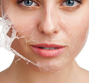 لایه برداری پوست  Peeling